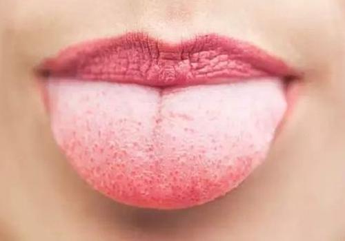 舌头发白是什么原因 舌头发白是什么原因引起的怎么办