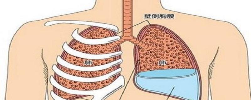 胸腔积液是怎么形成的（急性胸腔积液是怎么形成的）