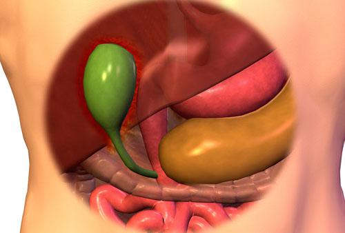 急性胆囊炎是怎么引起的 急性胆囊炎是怎样引起的