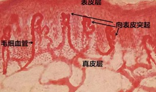 如何消除红血丝 消除红血丝的方法