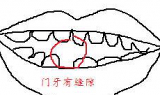 门牙中间有缝怎么办 了解一下这些内容