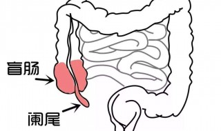 阑尾有什么作用 阑尾的作用是什么