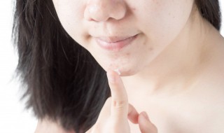 改善脸上痘痘最好的方法 改善脸上痘痘最好的方法有哪些