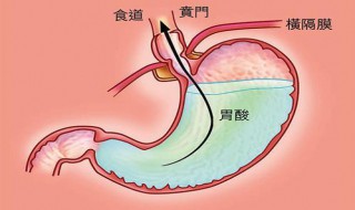 有点胃酸怎么办（有点胃酸怎么办快速缓解）