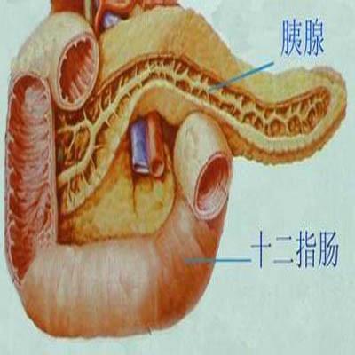 放屁多是胰腺癌吗