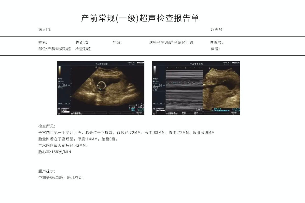 产科彩色超声报告图解 产科彩色超声报告图解大全