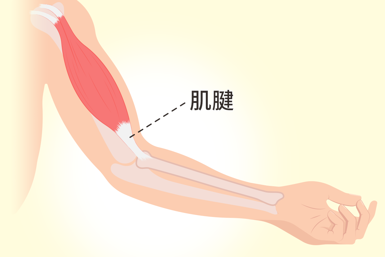 肌腱和韧带的区别图片 肌腱和韧带的区别图片对比