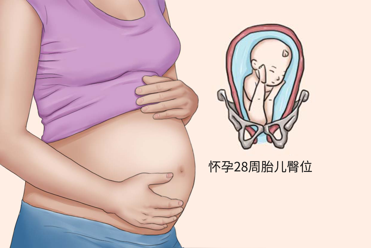 怀孕28周胎儿臀位图片（怀孕28周胎儿臀位图片）