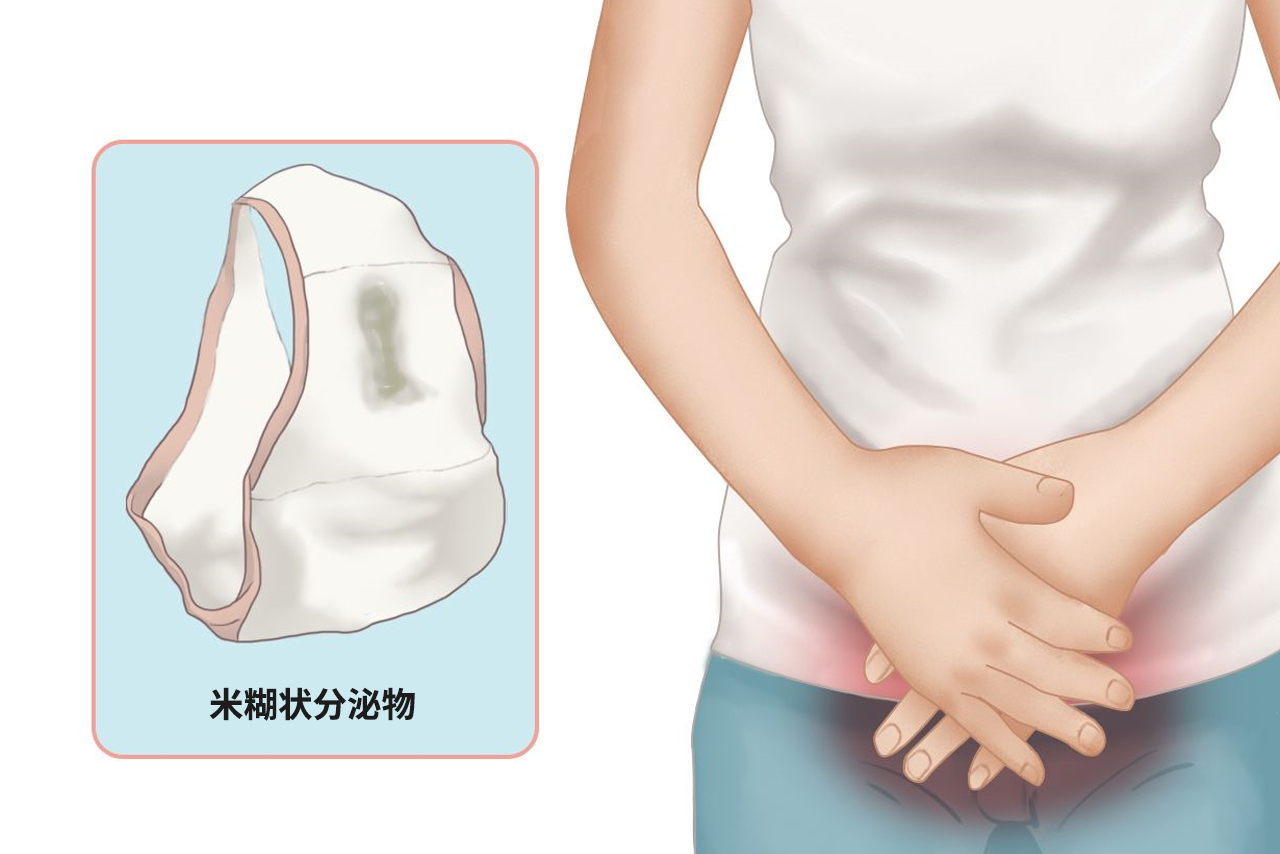 米糊状分泌物图片 米糊状分泌物图片大全