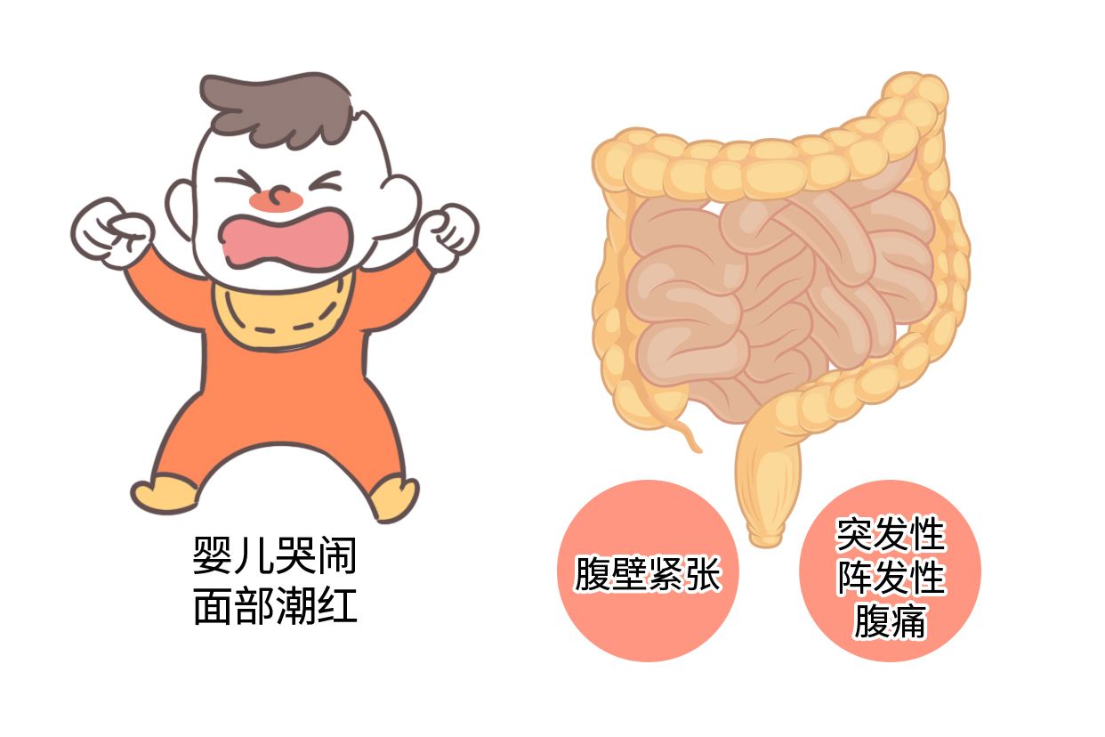 肠痉挛图片（肠痉挛图片难受图片）