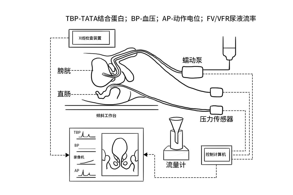 男性尿动力检查过程示意图