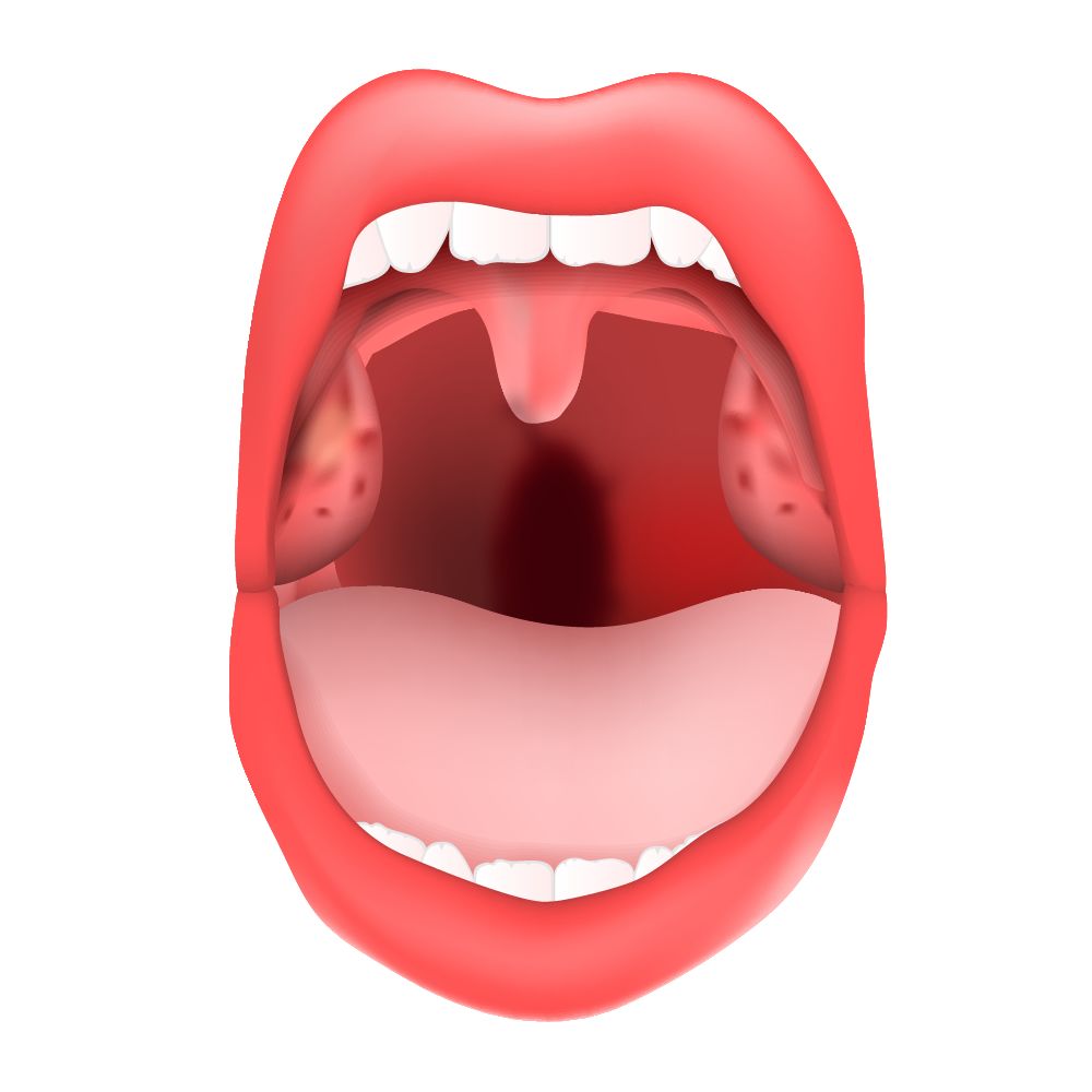 舌弓发炎图片（舌炎的症状图片舌头）