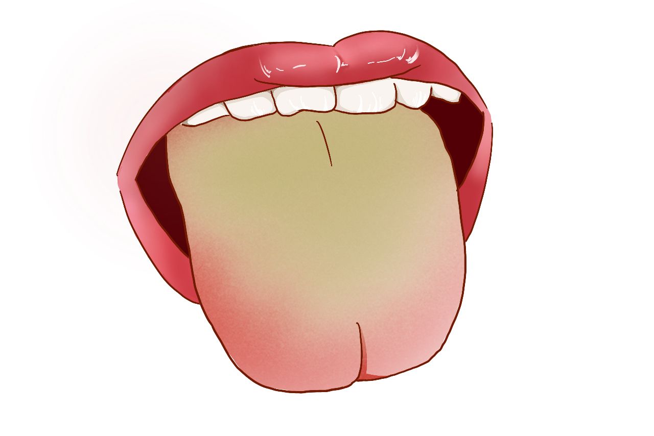 膀胱湿热舌苔图片 膀胱湿热舌苔图片
