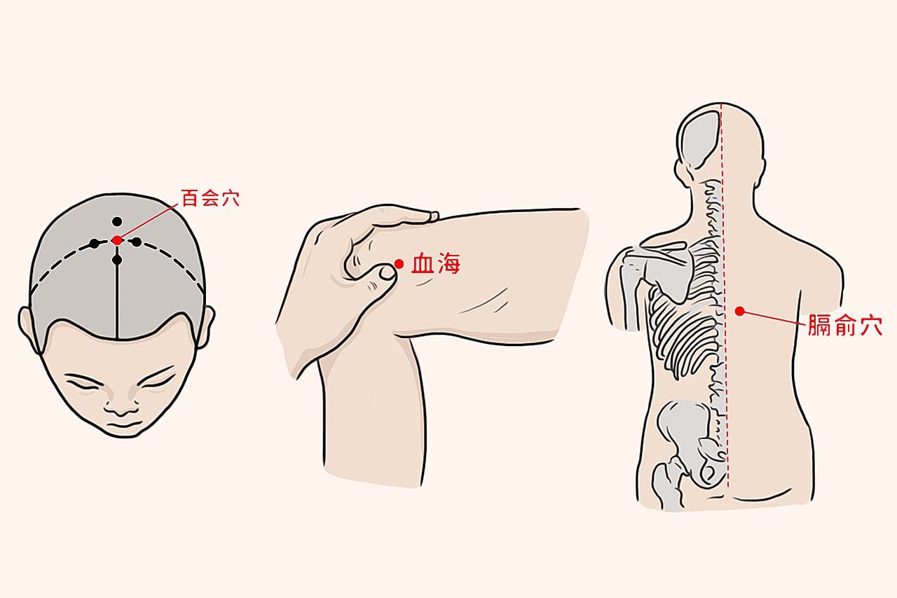 头晕刮痧的部位图解 头晕刮痧刮什么部位图