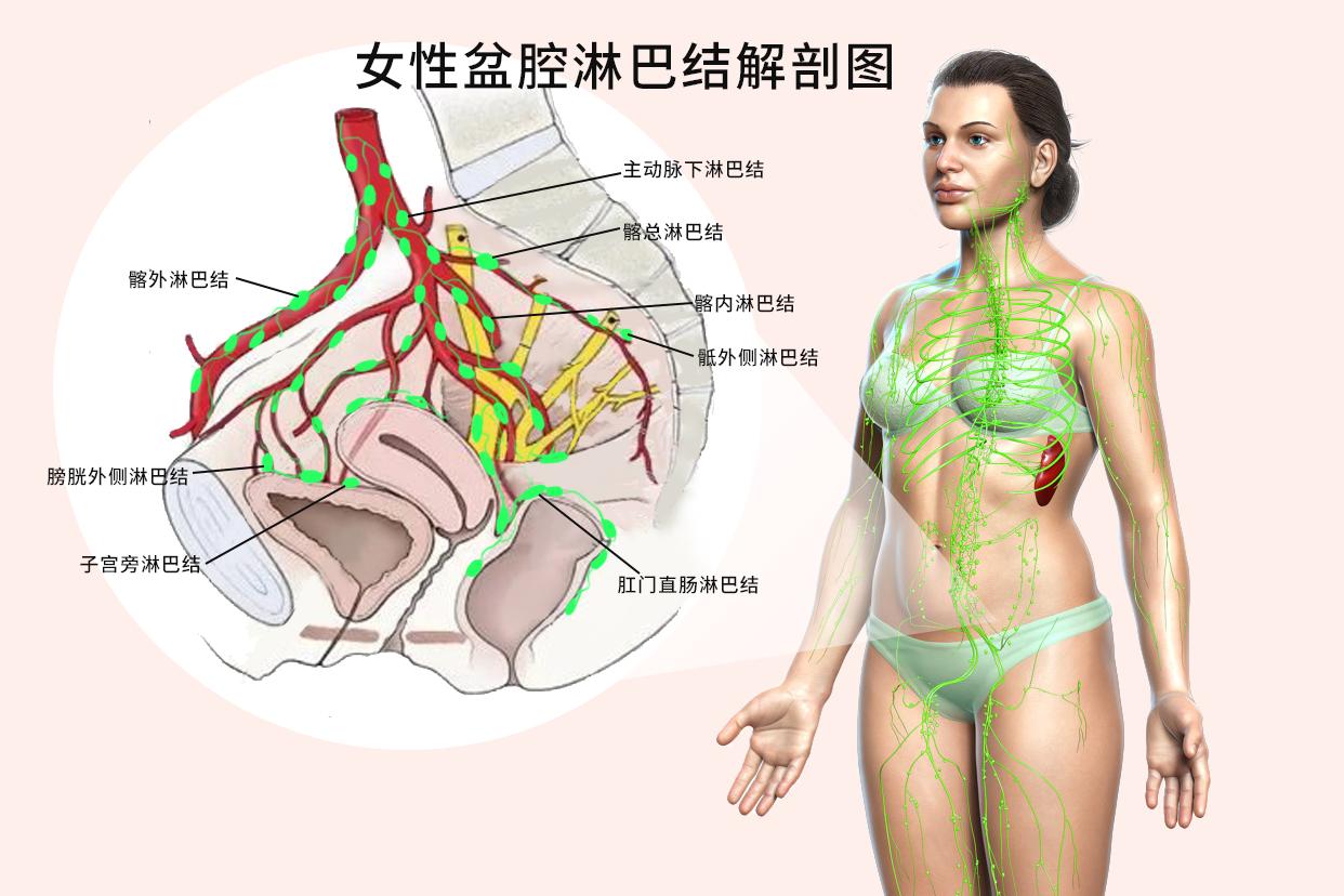女性盆腔淋巴结解剖图 女性盆腔淋巴结图片结构图