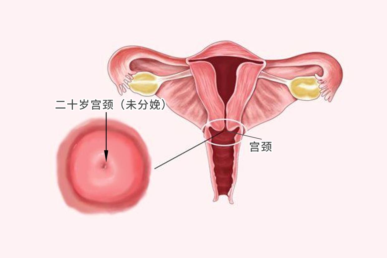 二十岁宫颈图片 20岁宫颈会有问题吗