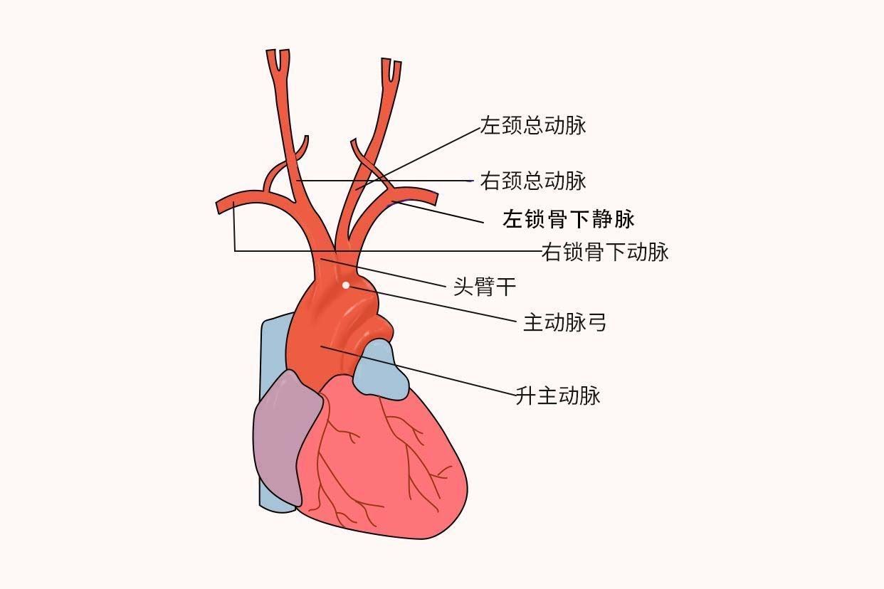 主动脉弓解剖图（主动脉弓解剖图片）